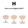 Hydrocolloid Acne Pimple Patch Spot Treatment