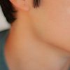 Cover Dot Acne Care (72 Dots) Acne Skin Blemish Treatment