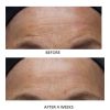Dr. Denese SkinScience Advanced Firming Facial Pads - Unveil Radiant Skin with Glycolic Acid, Peptides & Aloe Vera - 100 Count