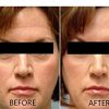 Vitamin C Serum 20% Pure L-Ascorbic Acid, Ferulic Acid