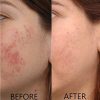 Vitamin C Serum 20% Pure L-Ascorbic Acid, Ferulic Acid