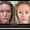 Anti Aging Eye Cream for Dark Circles and Puffiness