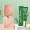 Acne Treatment Gel, BREYLEE Tea Tree Acne Spot Treatment