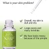 Korean Skin Care Marvel: Niacinamide 10% + Zinc 1% Serum - Pore Reducer, Even Skin Tone, Acne Solution