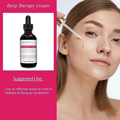 Looking for relief from skin redness and rosacea?