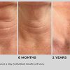 NassifMD Deco-Lift Neck Firming, Lifting Complex Serum