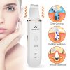 Skin Scrubber Face Skin Spatula Blackhead Remover Pore
