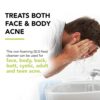 Humane Most-Power Pimple Wash - 10% Benzoyl Peroxide Acne Treatment for Face, Skin, Butt, Back, and Body - 8 Fl Oz - Dermatologist-Tested Non-Foaming Cleanser - Vegan, Cruelty-Free