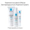 La Roche-Posay Effaclar Duo Dual Action Acne Treatment Cream - Clear, Radiant Skin with Gentle Care