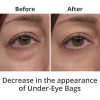 Fast Discount Eye Serum: Instantly Erase Under-Eye Bags, Wrinkles, and Dark Circles