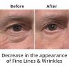 Fast Discount Eye Serum: Instantly Erase Under-Eye Bags, Wrinkles, and Dark Circles