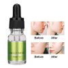 10ml Pore Therapy Serum - Essence for Smooth, Hydrated Skin, Pores Shrinking and Oil Control