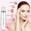 Blackhead Remover Vacuum – For Clear, Radiant Skin Anytime! 🌟