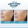 Anti Aging Resurfacing Exfoliating Peel Pads