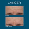 The Method: Polish Normal-Combination Skin
