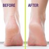 Heel-Seal - The #1 Liquid Skin Protectant for Cracked Heels