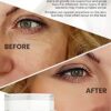 Anti-Zits Treatment Cream - Natural Formula for Clear and Balanced Skin, Targets Breakouts, Spots, and Cystic Acne - Ideal for All Skin Types
