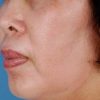 ZO SKIN HEALTH RETINOL SKIN BRIGHTENER