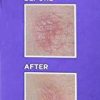 Mederma PM Intensive Overnight Scar Cream