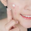 Neutrogena Rapid Clear Stubborn Acne Spot Treatment Gel