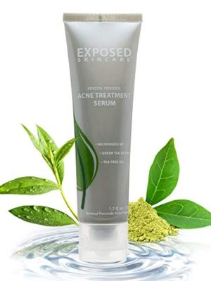 Reduces Pimple Size and Redness Skin Care Acne Treatment Serum