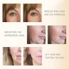 Achieve Salon-Quality Skin Tightening at Home – MLAY RF Facial & Body Machine