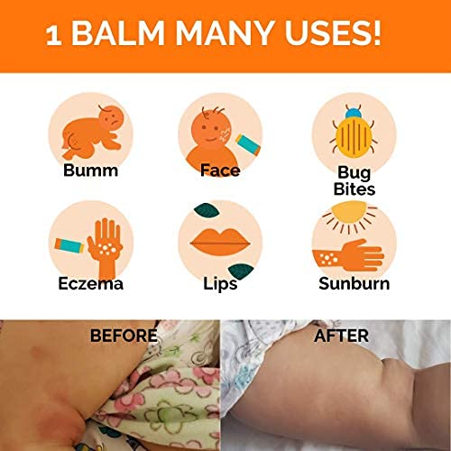 EmBeba Natural Diaper Rash Cream for Kids with Sensitive Skin