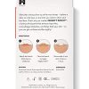 Hydrocolloid Acne Pimple Patch Spot Treatment