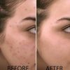 Vitamin C Serum 20% Pure L-Ascorbic Acid, Ferulic Acid