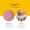 Peach Me Vulva Moisturizer – 100% Pure, Vegan OBGYN-Certified Balm for Dryness & Discomfort 🍑✨