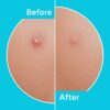 Tea Tree Oil and Hydrocolloid Pimple Patches for Face