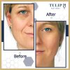 Active Anti-Wrinkle Firming Gel Vitamin A Retinol Moisturizer