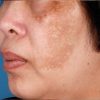 ZO SKIN HEALTH RETINOL SKIN BRIGHTENER