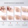 Transform Your Look with Face Lift Tape - Invisible Wrinkle Patches for Instant Face and Neck Lift