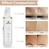 Skin Scrubber Face Skin Spatula Blackhead Remover Pore