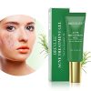 Acne Treatment Gel, BREYLEE Tea Tree Acne Spot Treatment