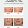 New Revolution Portable Face Massager.