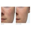 Dr. Dennis Gross Alpha Beta Extra Strength Daily Peel