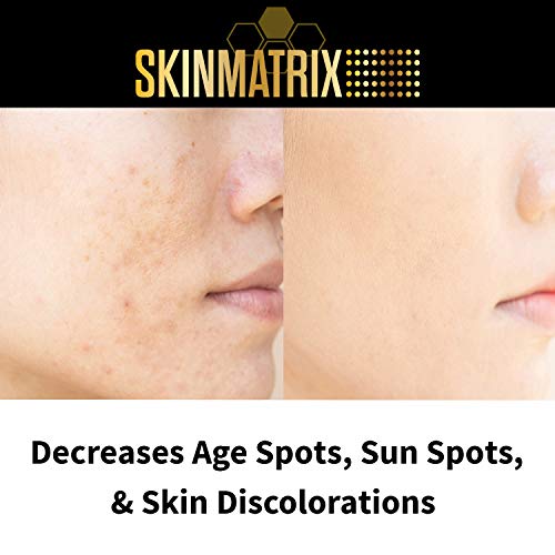 Dark Spot Corrector- Skin Brightening Cream Naturally Fades