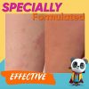 EmBeba Natural Diaper Rash Cream for Kids with Sensitive Skin