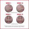 Neutrogena Stubborn Acne AM Face Treatment
