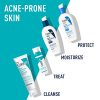 CeraVe Retinol Serum for Post-Acne Marks and Skin Texture - Image 4