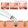 Blackhead Remover Vacuum – For Clear, Radiant Skin Anytime! 🌟