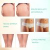Radio Frequency Skin Tightening, MLAY RF Radio Frequency Lifting