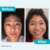 Proactiv+ 3 Step Advanced Skincare Acne Treatment
