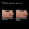 Age Refining Treatment Wrinkles for Mature Skin