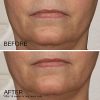 Achieve Youthful Skin with Neutrogena Firming Peptide Face Cream