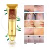 Advanced Scar and Stretch Mark Removal Gel