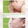 Anti-Zits Treatment Cream - Natural Formula for Clear and Balanced Skin, Targets Breakouts, Spots, and Cystic Acne - Ideal for All Skin Types