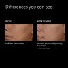 Intensive Brightening Therapy – Illuminate Your Skin with Pure Retinol, Niacinamide, and Hexylresorcinol – OmniSome Technology, 1 oz